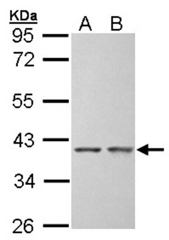 SGTA antibody
