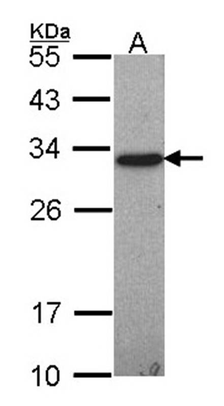 GSTO1 antibody