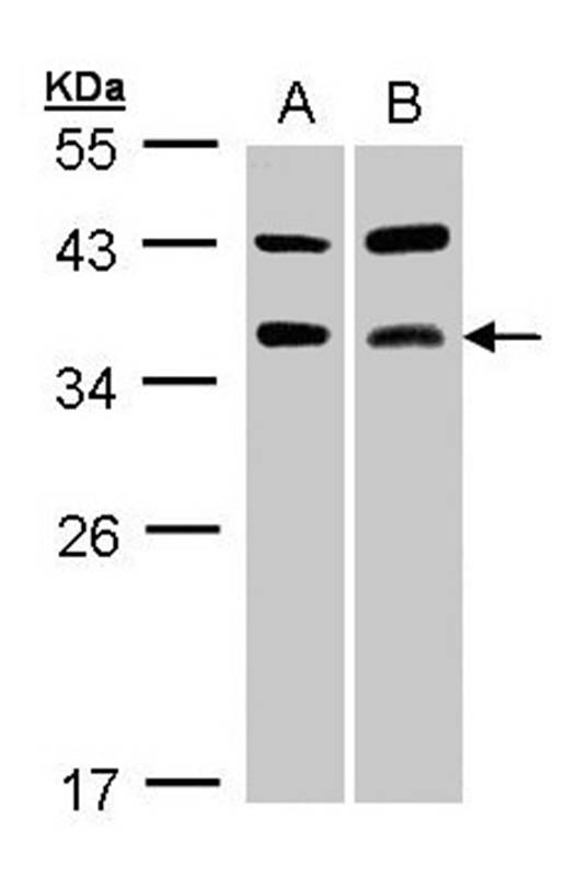 TRAP antibody