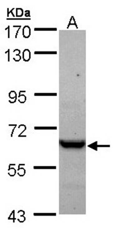 TCP epsilon antibody