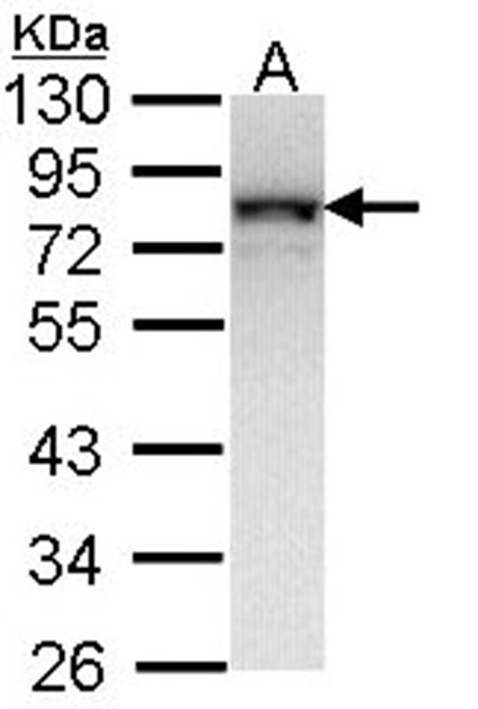 NDUFS1 antibody