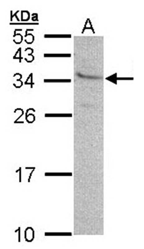 GEM antibody