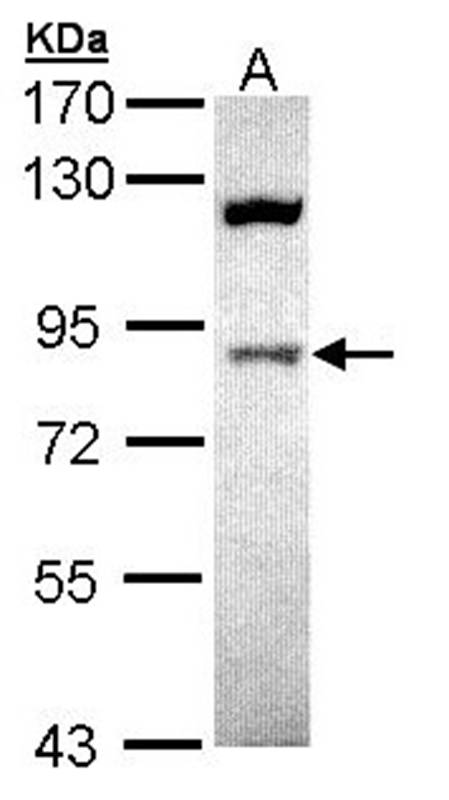 ACAP1 antibody