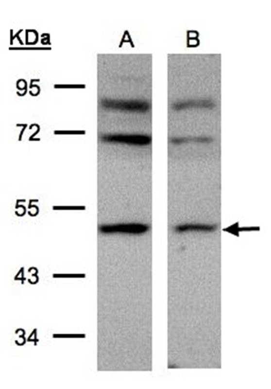 AP-2M1 antibody
