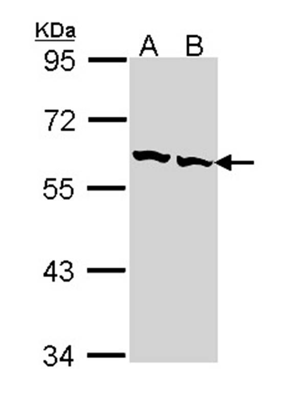 TCP beta antibody