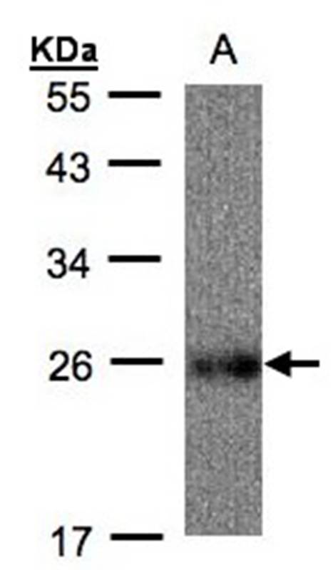 ubiquinol-cytochrome c reductase Rieske iron-sulfur polypeptide 1 antibody