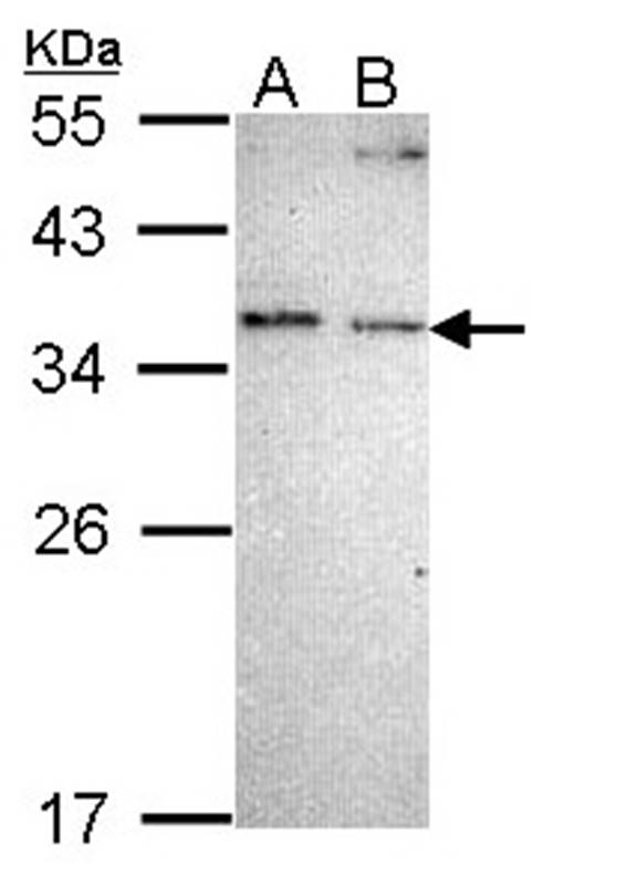 NOSIP antibody