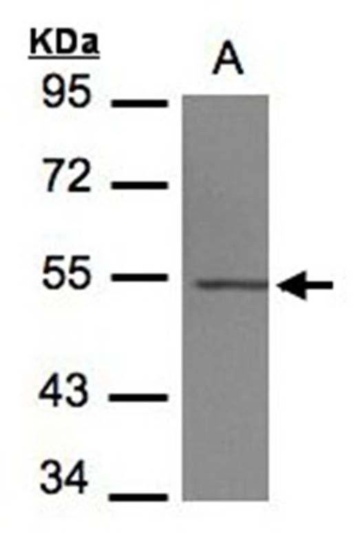 beta IV Tubulin antibody