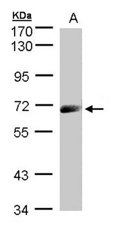 IL2Rbeta1 antibody