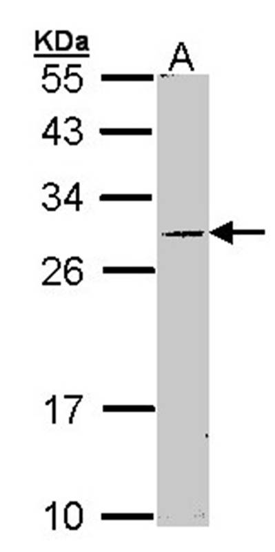 steroidogenic acute regulatory protein isoform 1 antibody