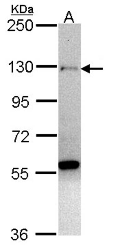 zinc finger protein 574 antibody
