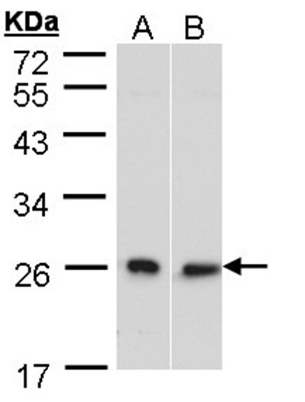 DNAJB6 antibody