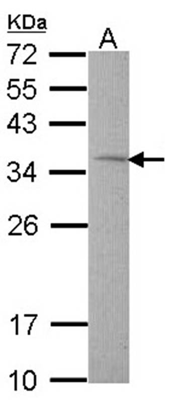 Rhodanese antibody