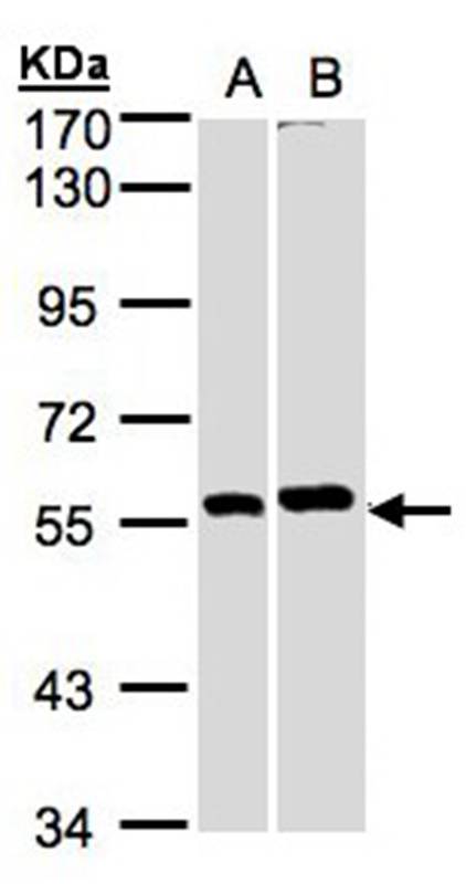 PPP3CB antibody