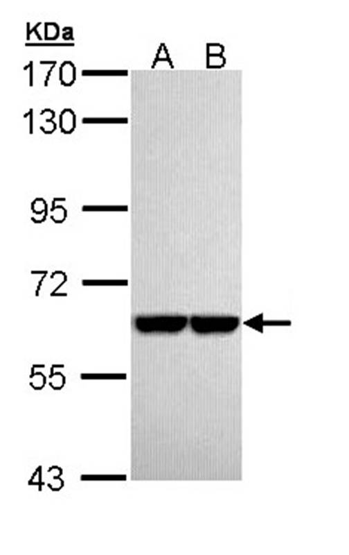Pyruvate Kinase(liver/RBC) antibody
