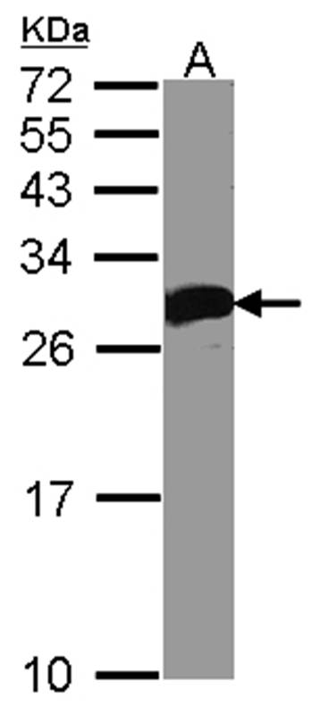 Deoxycytidine kinase antibody