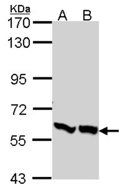 PFKFB3 antibody