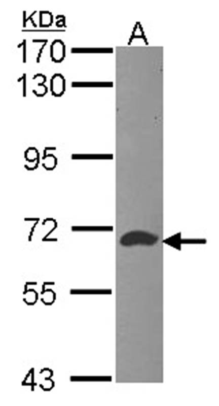 ATIC antibody
