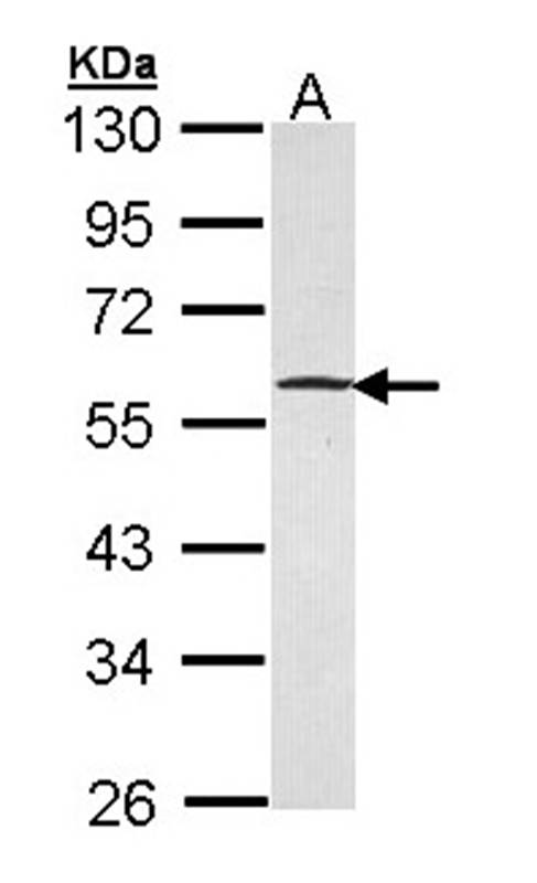 GABP-beta1 antibody