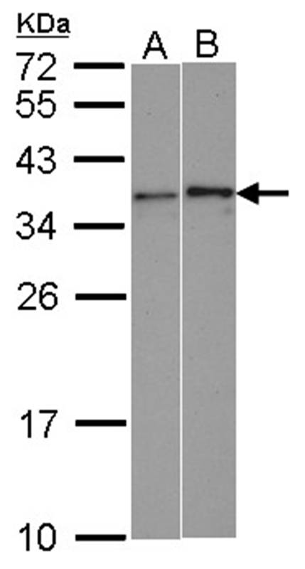 WBSCR22 antibody