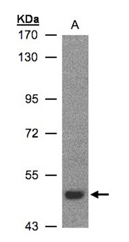 LBP antibody