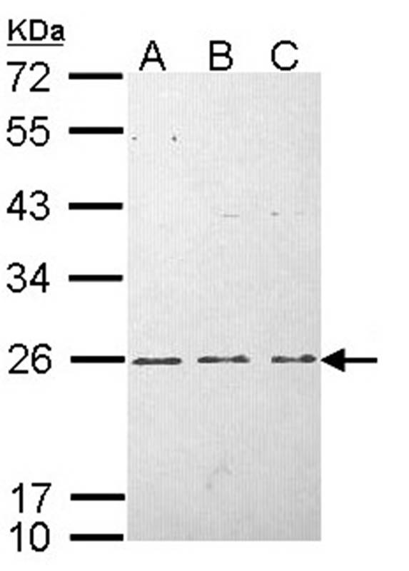 H-Ras antibody