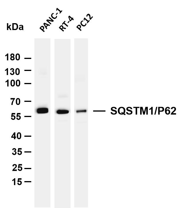 SQSTM1 antibody