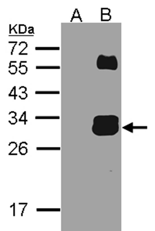 KLK7 antibody