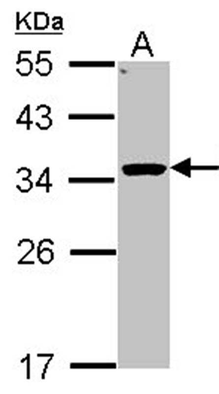 HSD11B1 antibody