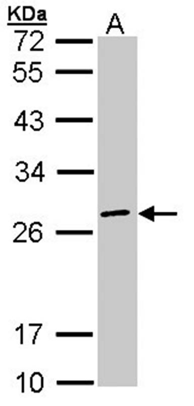 eIF3K antibody