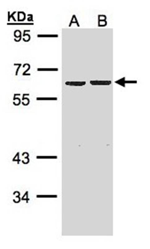 ZNF306 antibody
