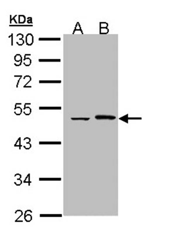 Epoxide hydrolase 1 antibody