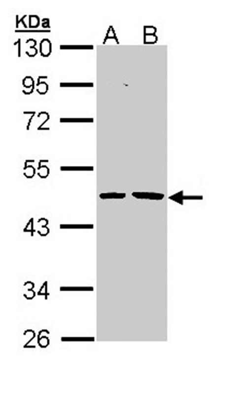 Epoxide hydrolase 1 antibody