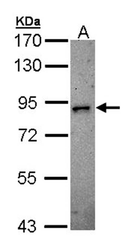 DCAMKL2 antibody