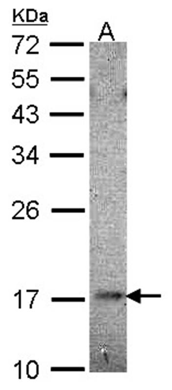 UBE2B antibody