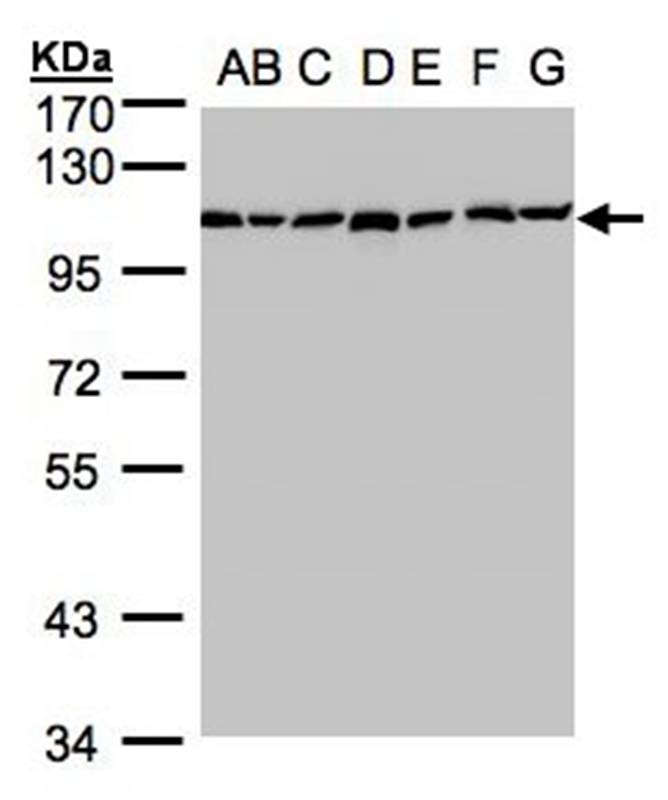 alpha Glucosidase II antibody