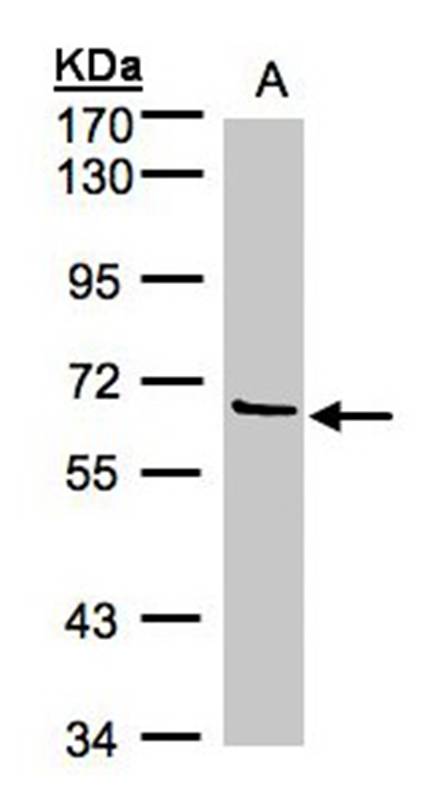 Factor XI antibody