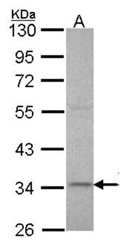 XRCC3 antibody