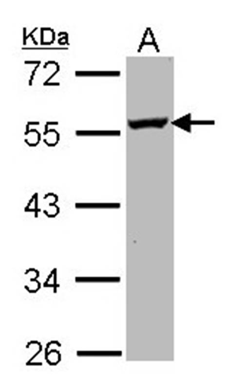 ODC antibody