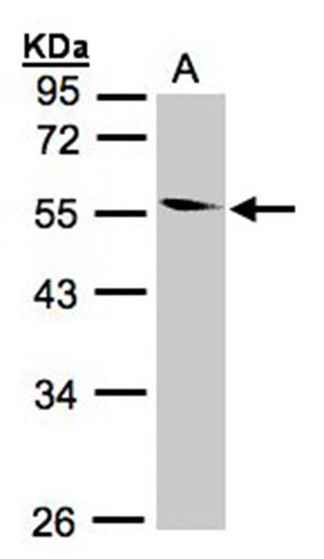 Coronin 1B antibody