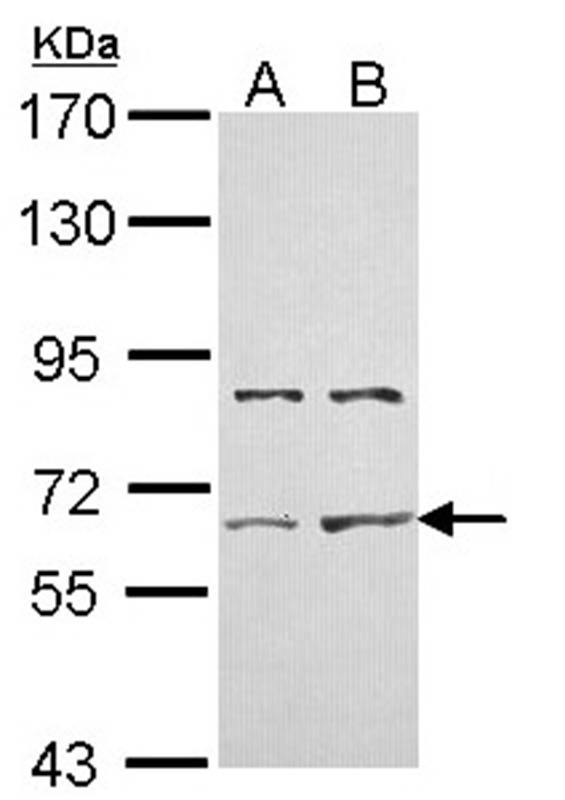 ACTR-II antibody