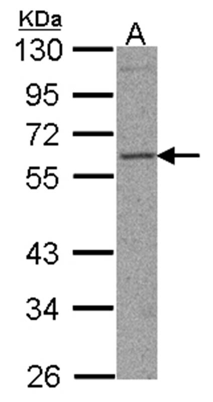 TFEB antibody