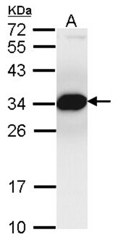 Proteasome inhibitor PI31 subunit antibody