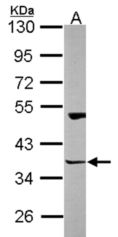 Homer-3 antibody