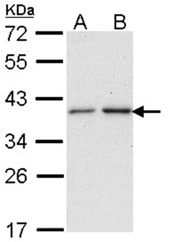 NAT2 antibody