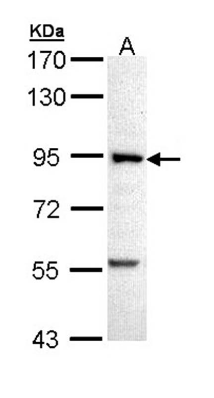 PFK antibody