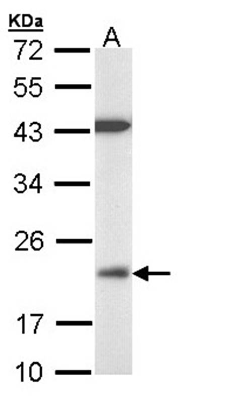 VHR antibody