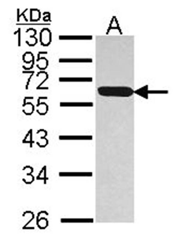 PDIR antibody