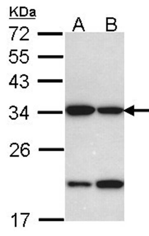 REA antibody