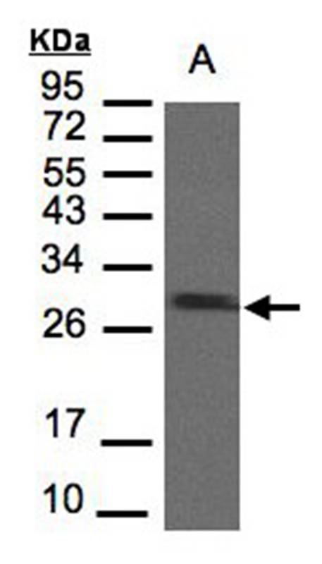 SDHB antibody